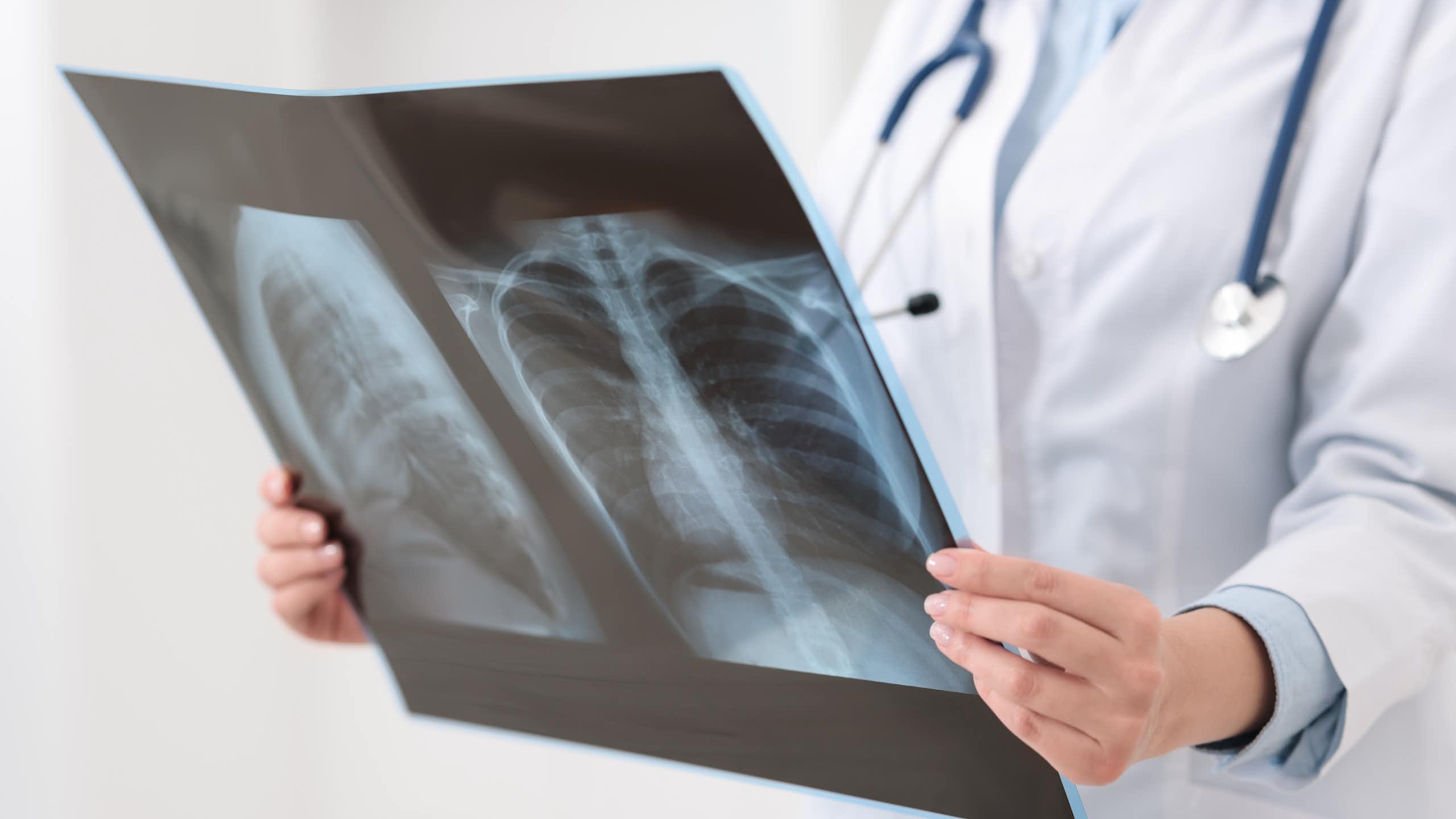 Médico olhando uma radiografia pulmonar